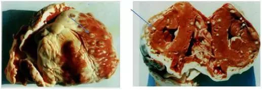 带绦虫卵形态_带绦虫卵图_带绦虫卵结构